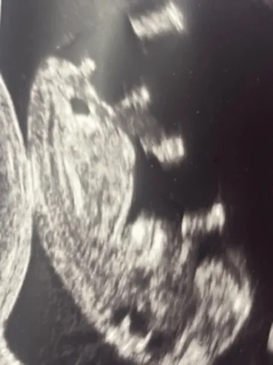 Dr. Julia Grewe – Gynäkologin – Babyultraschall