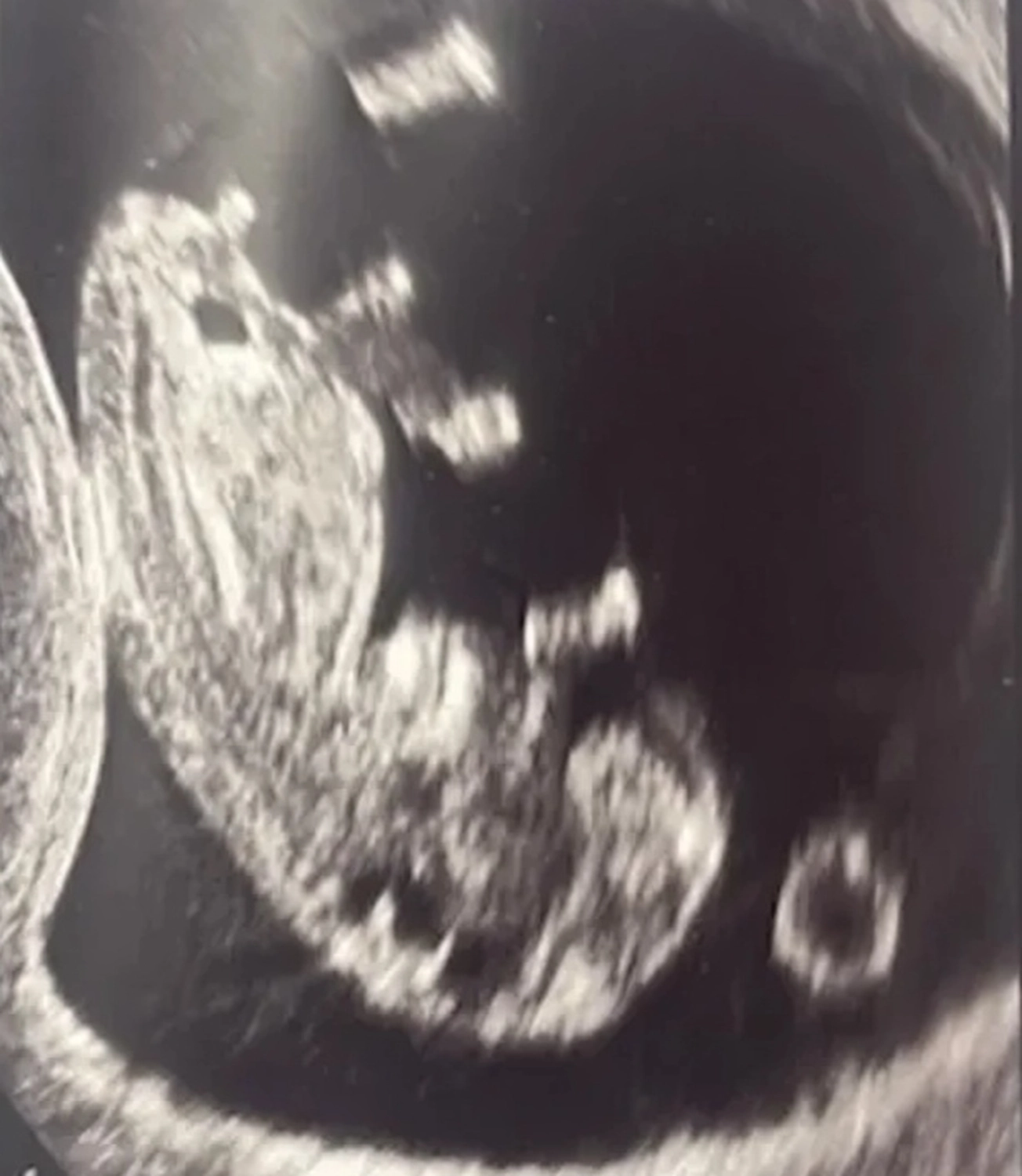 Dr. Julia Grewe – Gynäkologin – Babyultraschall